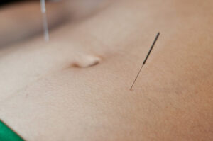 akupunktur-bauch-meridiane
